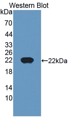 CTAG1B / NY-ESO-1 Antibody (aa1-180)