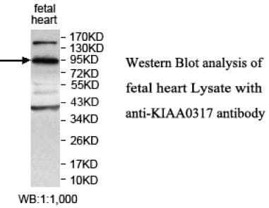 AREL1 / KIAA0317 Antibody (aa551-729)