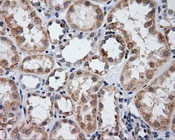 LIPG / Endothelial Lipase Antibody (clone OTI3C7)