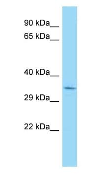 HMG20B / BRAF35 Antibody (aa101-150)