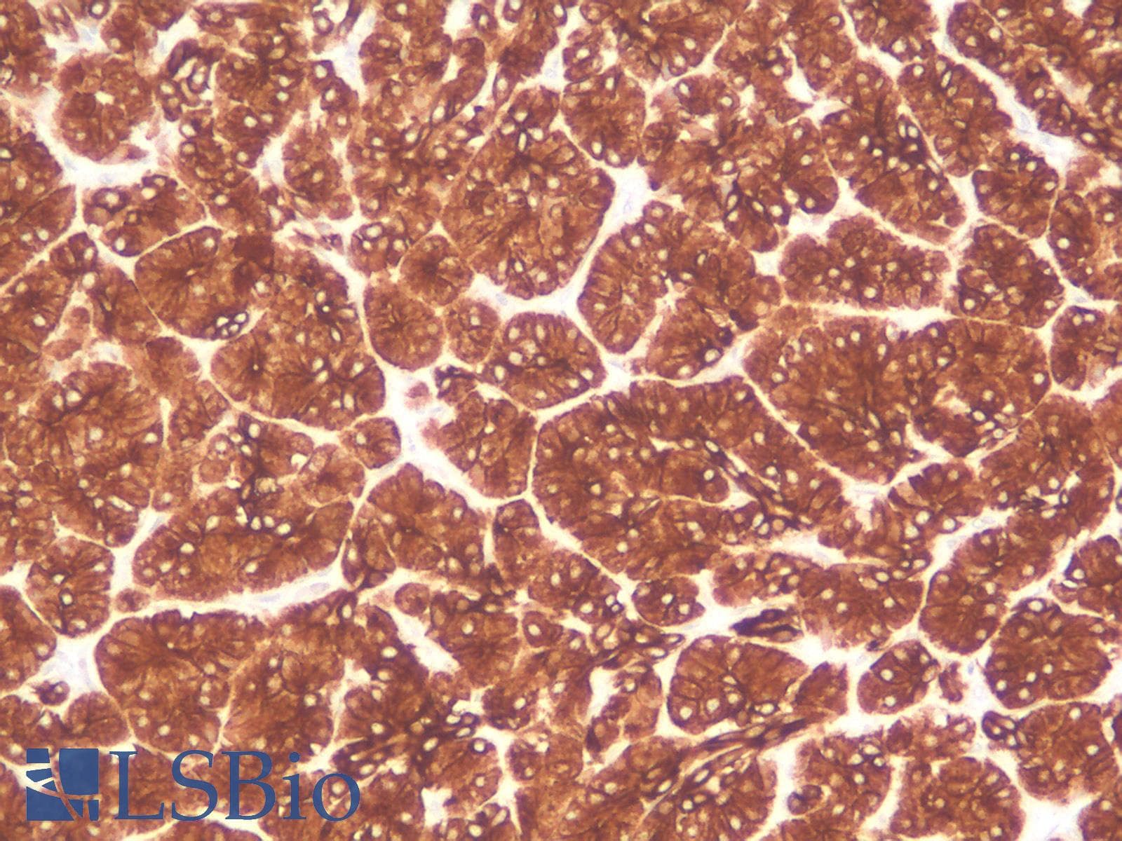 PathPlus™ Monoclonal Mouse anti-Human KRT18 / CK18 / Cytokeratin 18 Antibody (Concentrated, IHC)