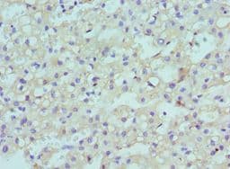 CBX8 Antibody (aa80-280)