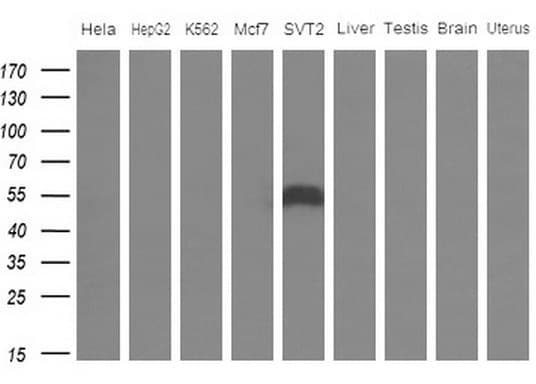 Monoclonal Mouse anti-Human APOH / Apolipoprotein H Antibody (clone OTI2C9, aa120-345, IHC, WB)