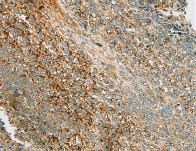 PRKAA1 / AMPK Alpha 1 Antibody