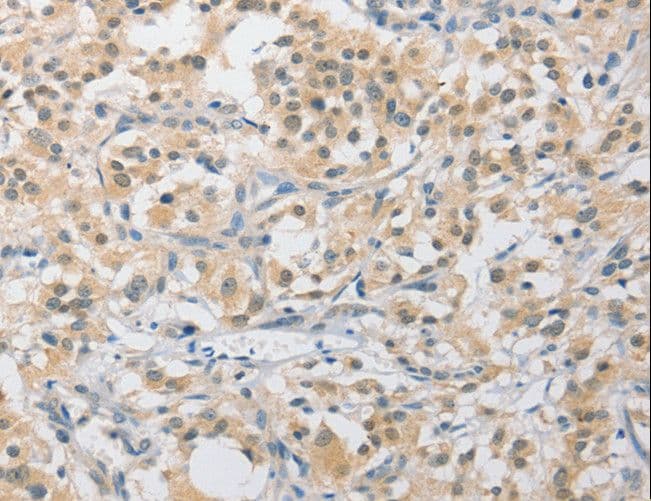 APLF / PALF Antibody