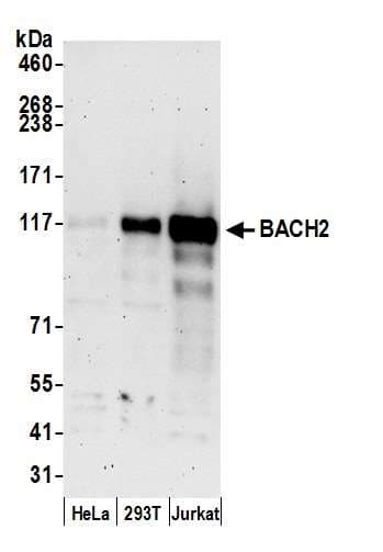 BACH2 Antibody (aa791-841)