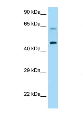 CRFR1 / CRHR1 Antibody (aa263-312)