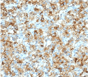Monoclonal Mouse anti-Human STAR Antibody (clone SARP1-1, IHC)