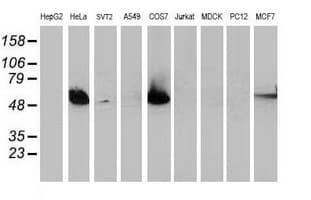 TP53 / p53 Antibody (clone OTI5B2)