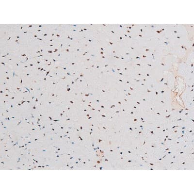 Polyclonal Rabbit anti-Human RELA / NFKB p65 Antibody (phospho-Thr435, IHC, IF, WB)