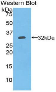 CD39 Antibody (aa98-352, FITC)