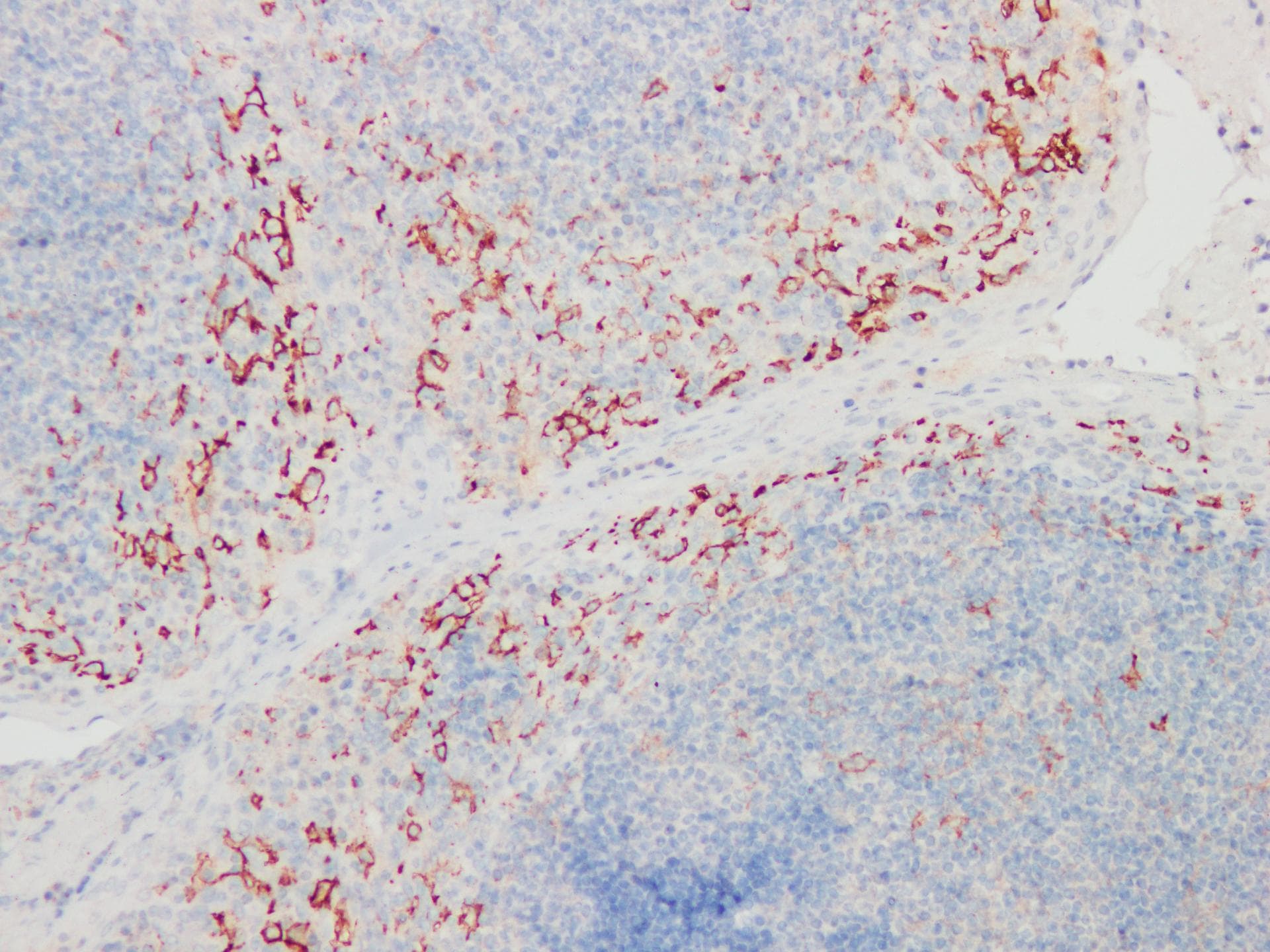 CD14 Antibody