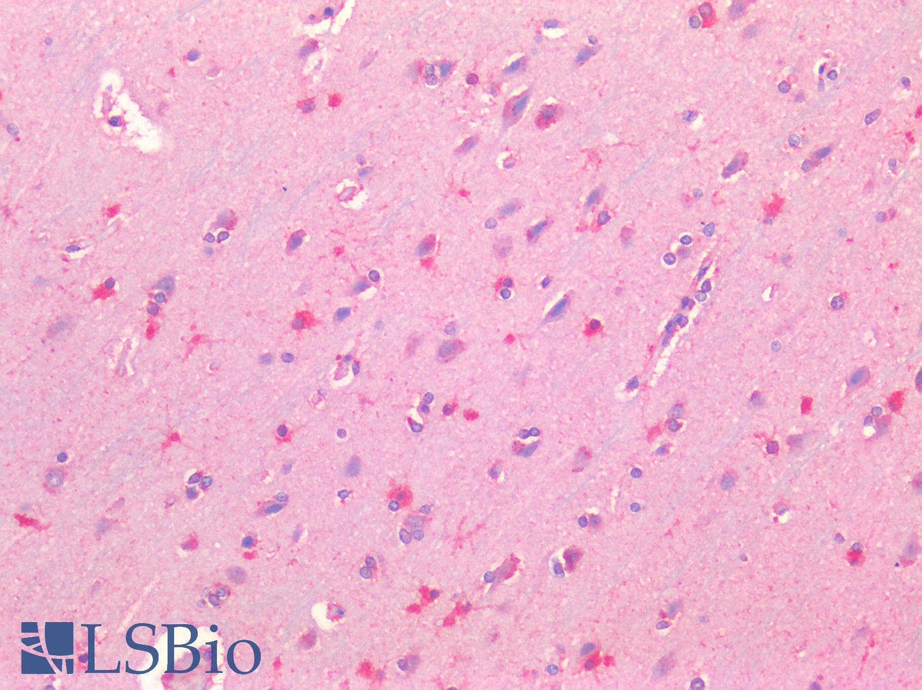 IHC-plus™ Monoclonal Mouse anti-Human TREM2 / TREM-2 Antibody (clone 08, Preservative Free, IHC)