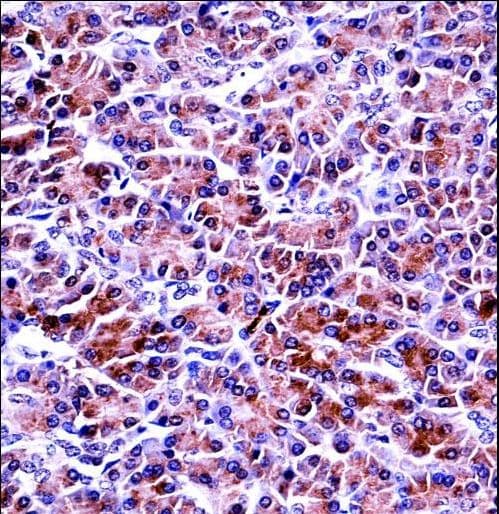 PRSS2 / Trypsin 2 Antibody (aa80-108)