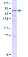 Human CT47A11 Protein (Recombinant GST)