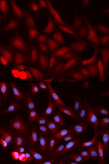 Polyclonal Rabbit anti-Human PSME1 Antibody (IHC, IF, WB)