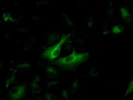 PathPlus™ KRT8 / CK8 / Cytokeratin 8 Antibody (clone 4D12)