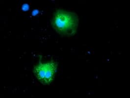 CALCOCO2 Antibody (clone OTI6E8)