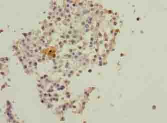DNAL4 / Dynein Light Chain 4 Antibody