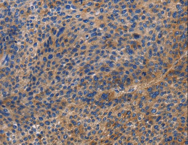 DOK4 Antibody