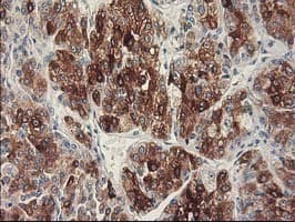 CYP2C9 / Cytochrome P450 2C9 Antibody (clone OTI3D2)