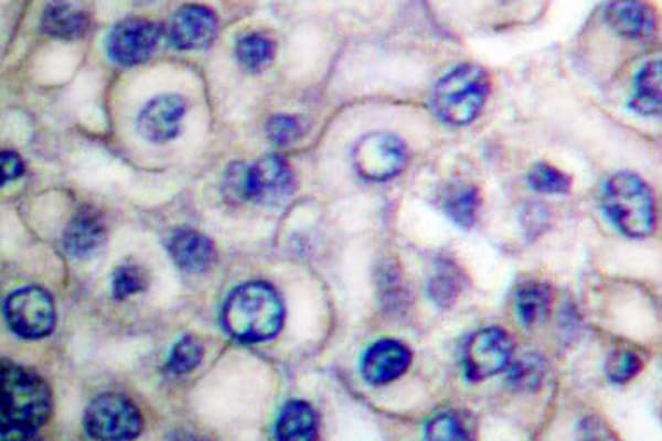 Polyclonal Rabbit anti-Human EGFR Antibody (Glu687, IHC, IF, WB)