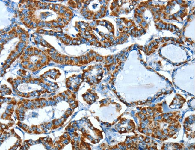 ALDH6A1 Antibody