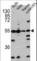 CASP2 / Caspase 2 Antibody (aa198-226)