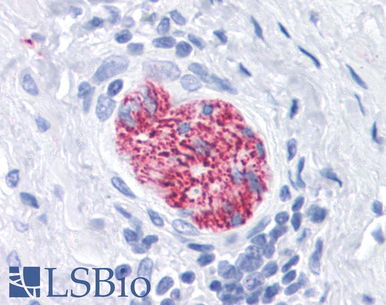 IHC-plus™ Monoclonal Mouse anti-Human TUBB3 / Tubulin Beta 3 Antibody (clone TU-20, C-Terminus, IHC, WB)