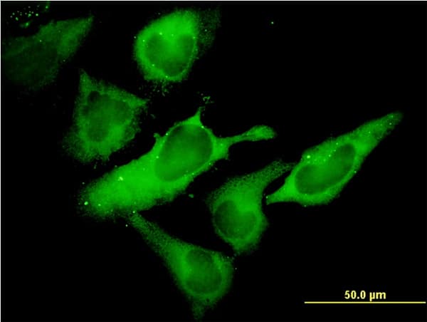 Monoclonal Mouse anti-Human EIF2S1 Antibody (clone 3H12-C11, IF, WB)