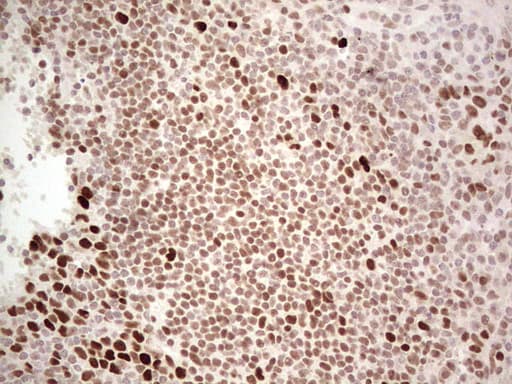 RB1 / Retinoblastoma / RB Antibody (aa309-590, clone OTI10H9)