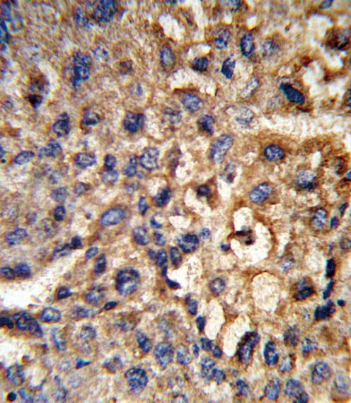 Polyclonal Rabbit anti-Human HSD17B12 Antibody (aa126-155, IHC, WB)