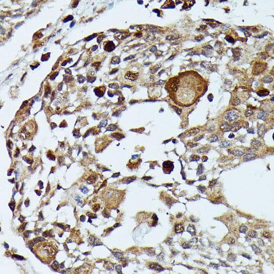 MAP3K3 / MEKK3 Antibody