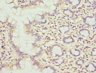 Polyclonal Rabbit anti-Human MBTPS1 / S1P Antibody (IHC, WB)