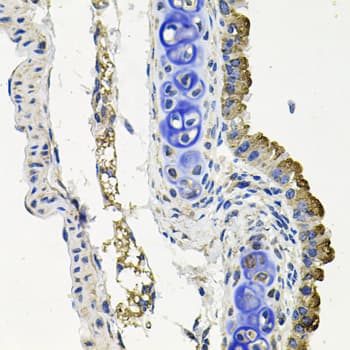 MARK1 / MARK Antibody