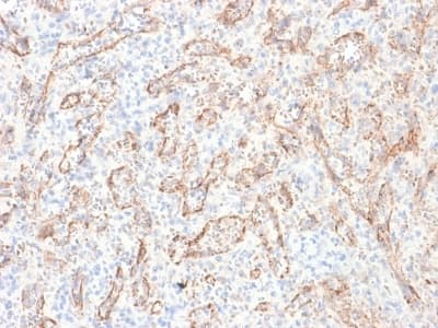 TNFSF15 / TL1A / VEGI Antibody (clone rVEGI/1283)