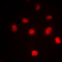 Histone H4 Antibody (Acetyl-Lys5)