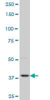 PBK / TOPK Antibody (clone 4A10)