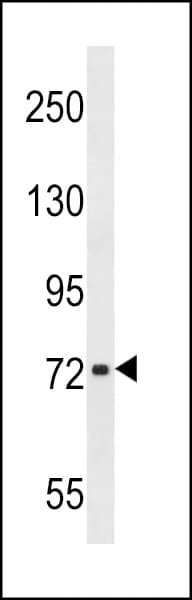 Polyclonal Rabbit anti-Human CHADL Antibody (aa406-434, WB)