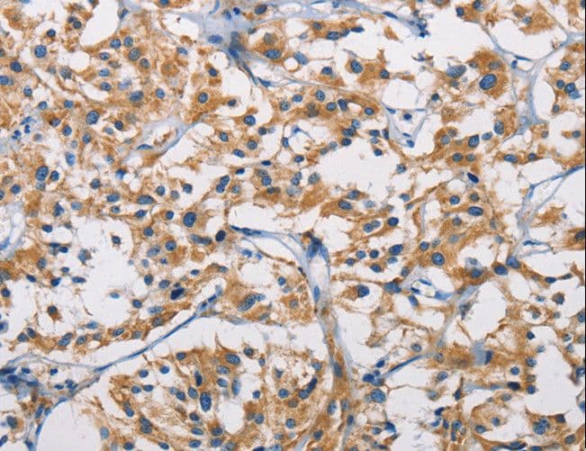 HK1 / Hexokinase 1 Antibody