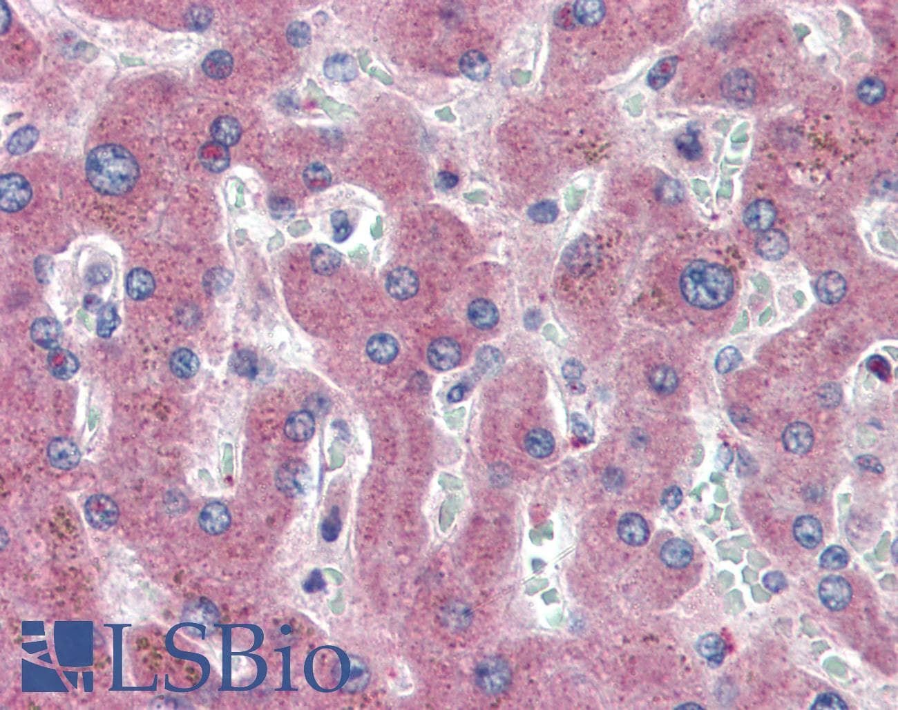 IHC-plus™ Polyclonal Rabbit anti-Human c-Met Antibody (C-Terminus, IHC)