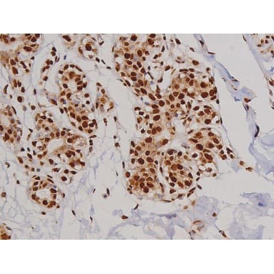 FAK / Focal Adhesion Kinase Antibody (phospho-Tyr397)