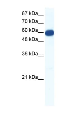 SLC18A1 / VMAT1 Antibody (aa103-152)