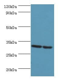 Polyclonal Rabbit anti-Human PNP / Nucleoside Phosphorylase Antibody (aa1-289, IHC, WB)