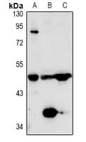 CPB2 / TAFI Antibody