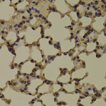 RNGTT / HCAP Antibody