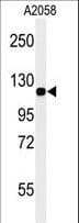 MCAM / CD146 Antibody (aa532-558)