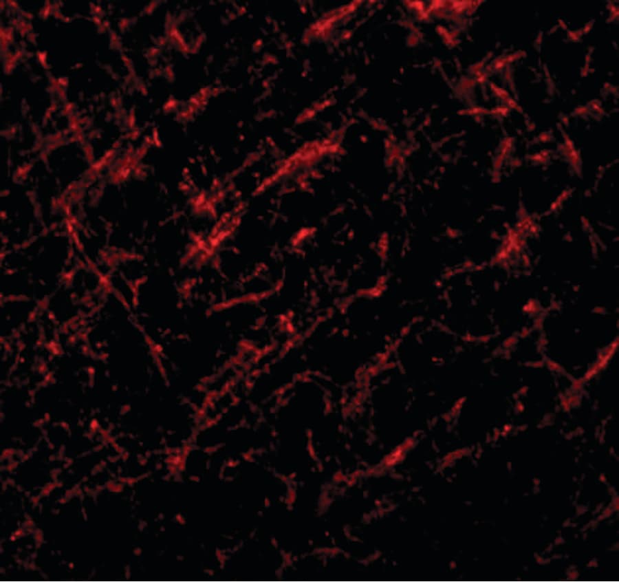 JMJD6 / PSR Antibody