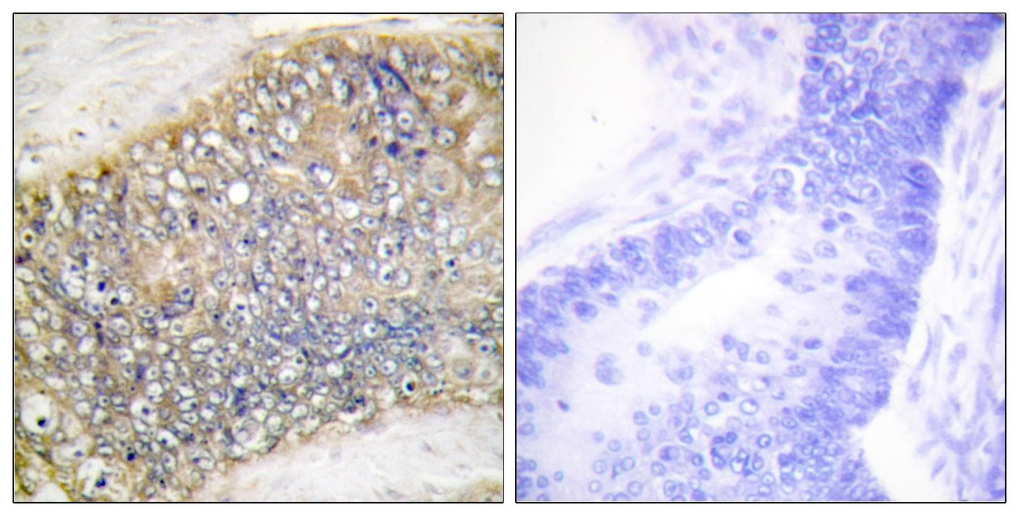 Polyclonal Rabbit anti-Human TNFSF13 / APRIL Antibody (IHC, IF, WB)