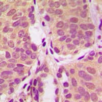 Polyclonal Rabbit anti-Human PIK3R1 / p85 Alpha Antibody (Internal, IHC, WB)